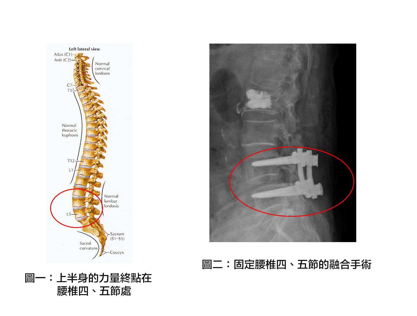 脊椎骨疼痛的原因 脊柱疼痛的原因 脊椎按压疼痛的原因 脊柱痛是什么原因