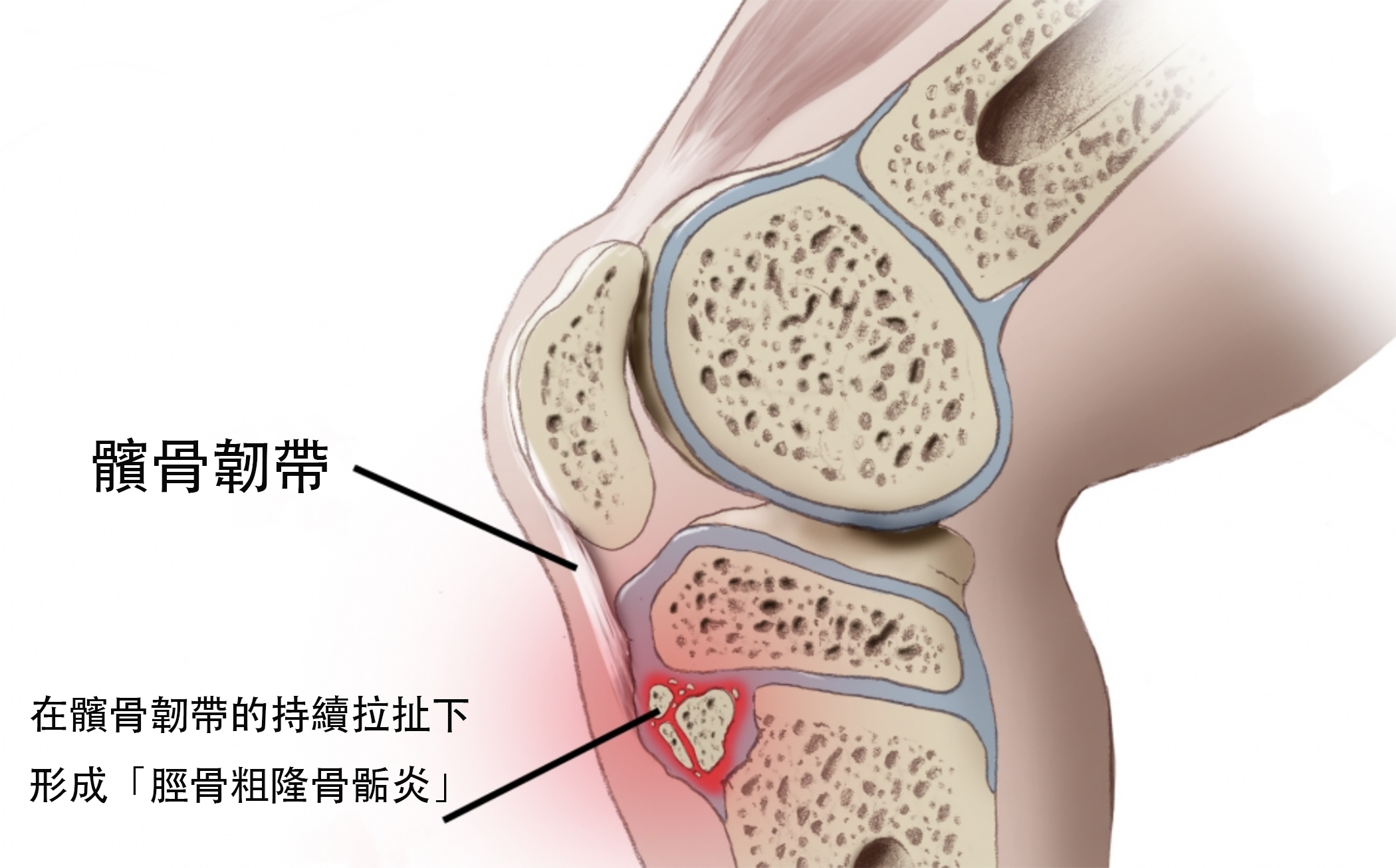 青春期的膝蓋痛要帶去看醫生嗎 福雅骨科 家庭醫學科診所